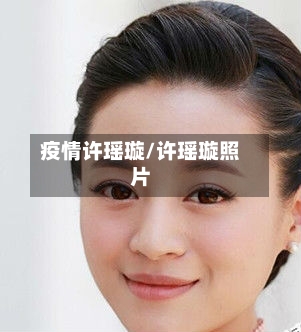 疫情许瑶璇/许瑶璇照片-第2张图片