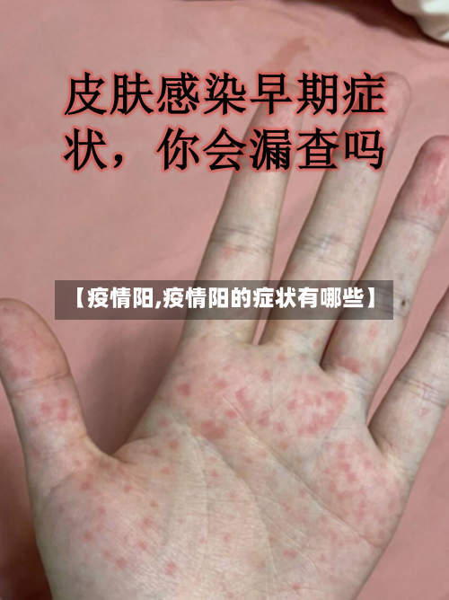 【疫情阳,疫情阳的症状有哪些】-第1张图片