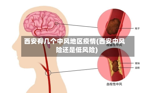 西安有几个中风地区疫情(西安中风险还是低风险)-第3张图片