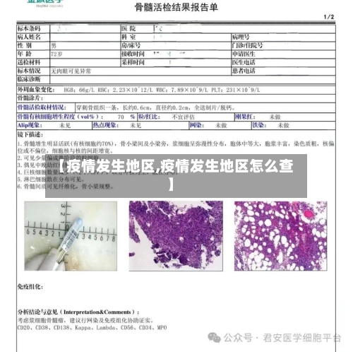 【疫情发生地区,疫情发生地区怎么查】-第3张图片