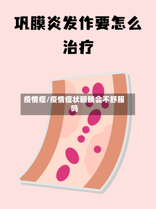 疫情症/疫情症状眼睛会不舒服吗-第1张图片