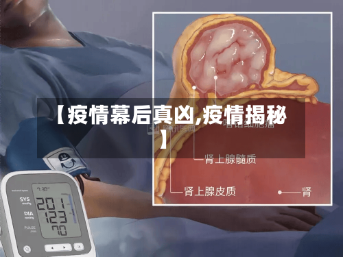 【疫情幕后真凶,疫情揭秘】-第1张图片